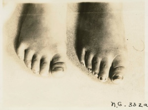 Image of Foot of a child and that of a woman